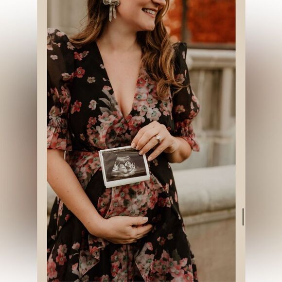 ASOS DESIGN dark sleeve voile midi tea dress with puff sleeves - Picture 2 of 7